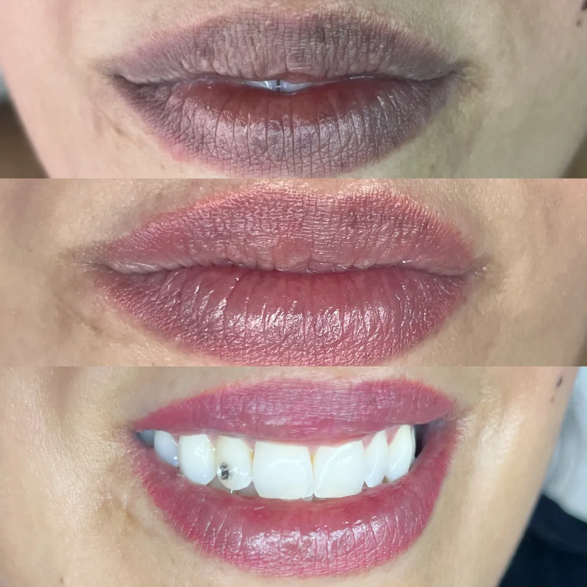 Micropigmentação Labial cicatrizada — resultado natural em Setúbal